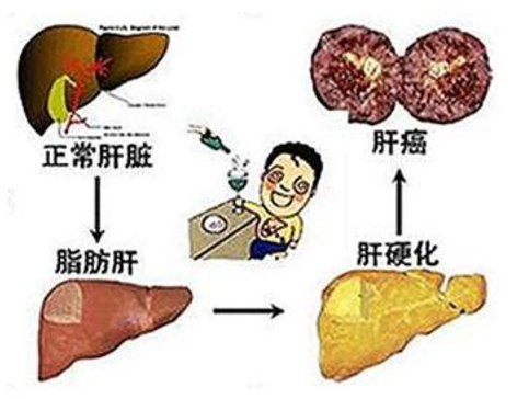 中度脂肪肝禁止吃什么？