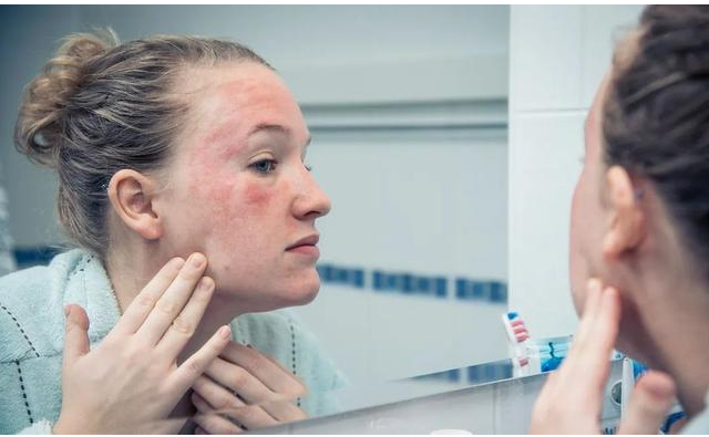 春季敏感皮肤易过敏？这些预防要注意！