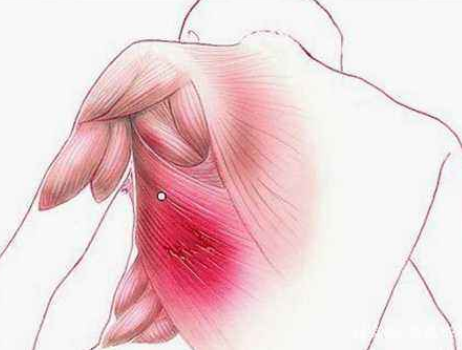 有哪些常见的运动损伤？如何有效预防及正确处理运动损伤？