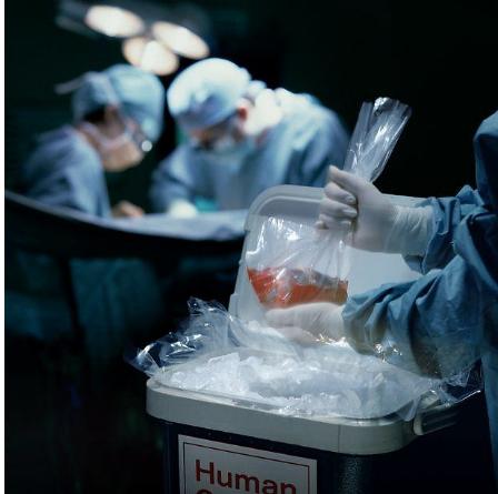 世界首例猪肾脏移植人体手术成功，他是如何实现的？异种移植真的成真了吗？