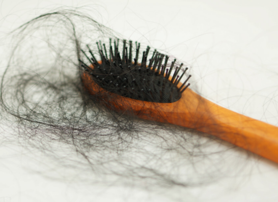 头发一天就油腻，是脂溢性皮炎的原因？溢脂性皮炎引发的危害？