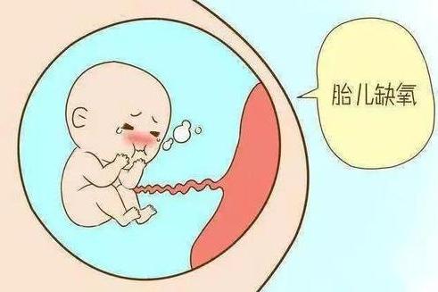 胎儿缺氧怎么办?胎儿为什么会缺氧?