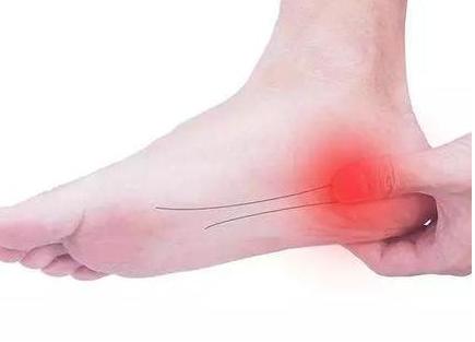脚痛的原因是什么?哪些因素会导致脚痛呢?