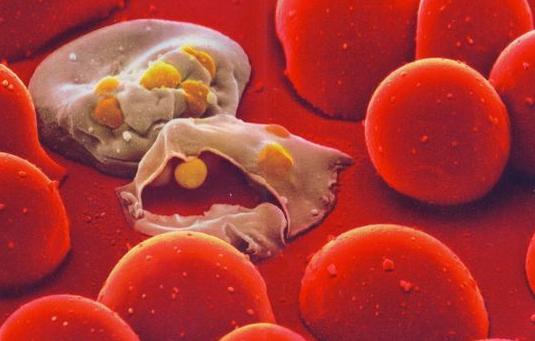 疾病指南|疟疾是什么?疟疾的症状有哪些?