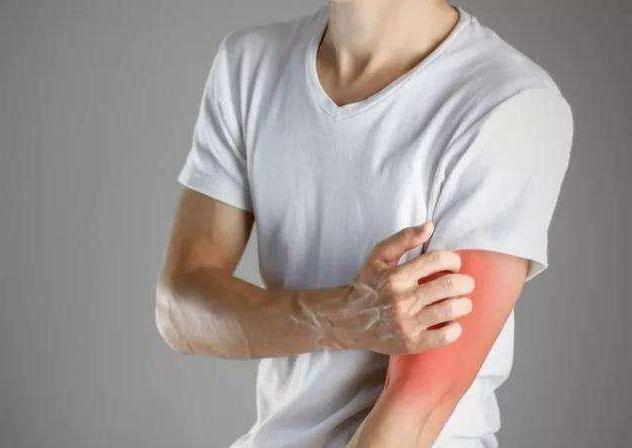 秋季最容易得什么皮肤疾病?最新关于秋季皮肤疾病的预防方法 秋季最容易得什么皮肤疾病?最新关于秋季皮肤疾病的预防方法