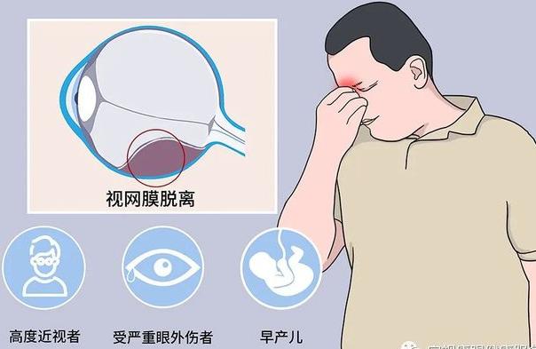 视网膜脱离到底是什么？视网膜脱离怎么预防？