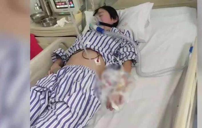 被姐夫投毒女孩已完成肺移植手术，主治医生表示女孩目前已苏醒！