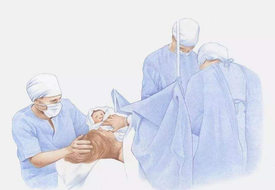 剖腹产多久后可以锻炼身体?