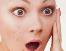 青春期女孩脸上长痘痘是什么原因?长痘痘是什么原因导致的?