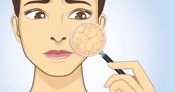 怎样改善干性皮肤？干性皮肤护肤步骤来啦 一起保护自己的脸蛋吧！