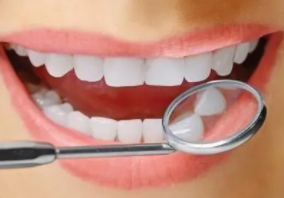 比较好的美白牙齿方法,有什么办法美白牙齿比较好?