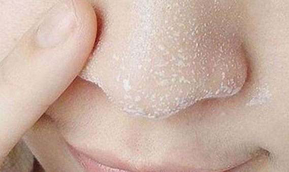 鼻子老师干燥起皮是为什么？哪些习惯会导致鼻子毛孔增大更严重？