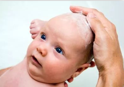 宝宝头皮上有头皮屑一样的是什么?2022去除宝宝头垢最好的方法