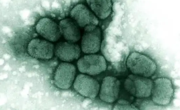 猴痘病毒已发生人际传播 在欧洲多国发现猴痘病毒已发生人际传播