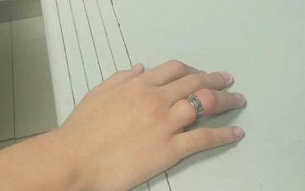 戒指拿不下来手肿了怎么办？这几个小办法可以帮你把戒指取下来！