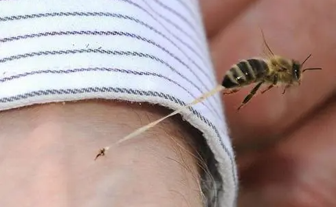 蜜蜂蜇伤后蜂针要拔掉吗?被蜜蜂蛰了怎么消肿止痛?