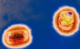 猴痘可以通过飞沫传播!中国印发2022年版猴痘诊疗指南