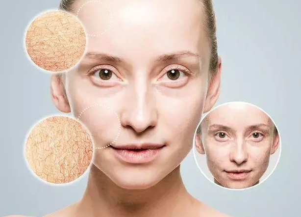 夏季皮肤敏感出油是怎么回事？哪些方法可以有效修复皮肤屏障？
