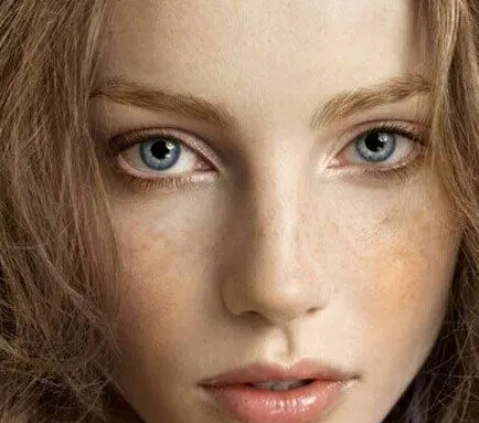 吃什么水果可以淡化黑色素和斑点（黑色素和斑点的解决方法）