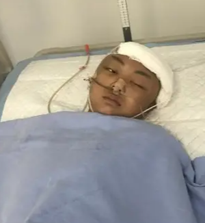 高考生查分第2天突发脑出血住进ICU,突发脑出血发生前会有哪些症状？