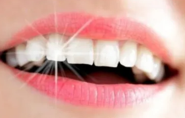 牙齿美白的方法 有哪些牙齿美白的偏方不可信?
