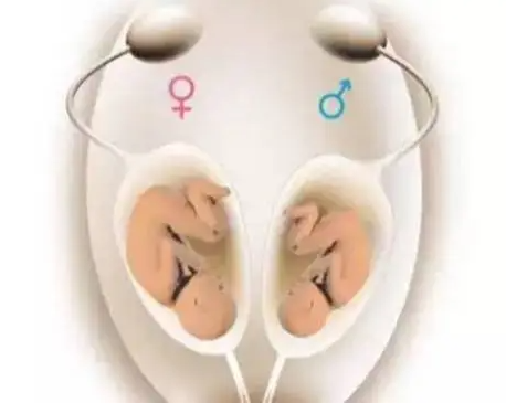 想生双胞胎的孕前准备（怎么备孕双胞胎成功率高）