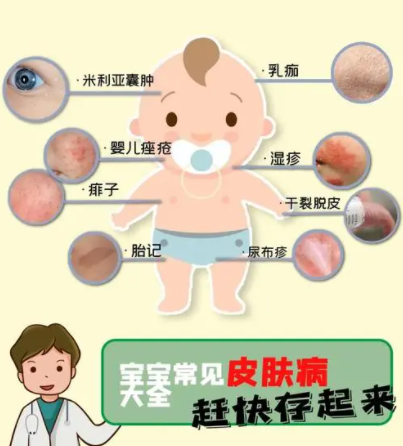 宝宝出现荨麻疹怎么办？荨麻疹有哪些典型的症状？