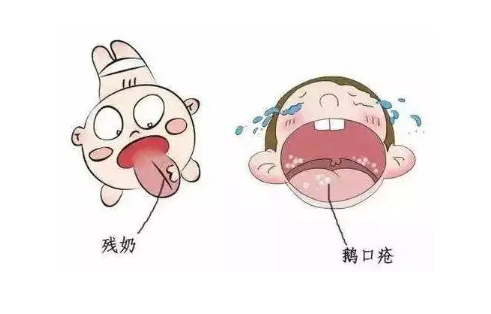 阳了发烧会引起口疮吗(口疮可以用冰硼散敷吗)