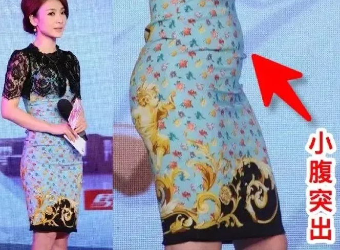小肚子突起就是骨盆前倾吗(骨盆前倾居家矫正的方法2022)
