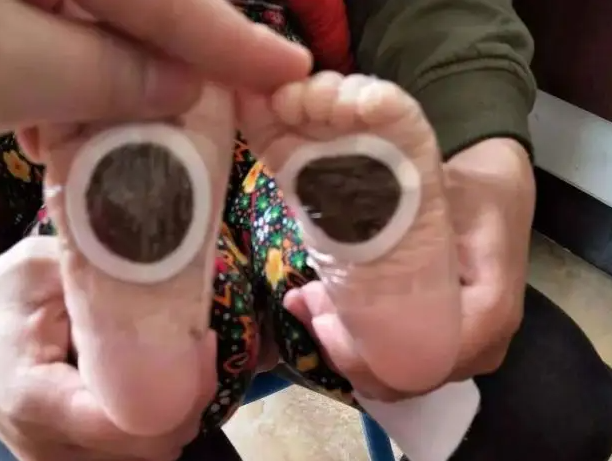 秋冬可以贴艾草贴取暖吗(秋冬贴艾草贴可以预防宫寒吗)