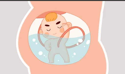 胎儿肾积水是否要终止妊娠(胎儿肾积水怎么办) 胎儿肾积水是否要终止妊娠(胎儿肾积水怎么办)