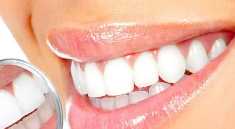 牙齿美白最快的方法是什么（冷光美白牙齿副作用有哪些）