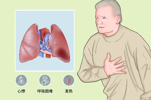 肺源性心脏病是怎么回事（肺源性心脏病该怎么治疗）