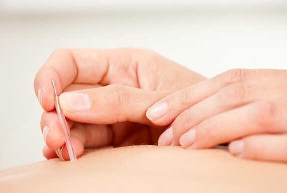 针灸疗法真的能瘦身吗（哪种人不适合针灸减肥）