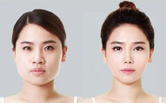 怎样可以瘦脸呢？分享九种有效的瘦脸方法