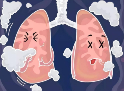 甲流也可能引起白肺吗?甲流得了白肺该怎么治？