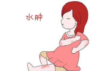 孕期水肿的原因是什么?孕晚期水肿该怎么办 孕期水肿的原因是什么?孕晚期水肿该怎么办