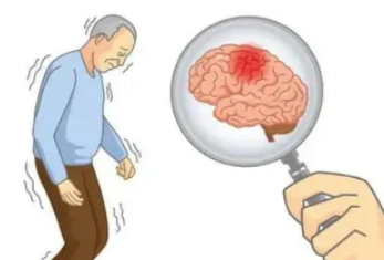 脑血栓病人吃什么好?脑血栓病人在生活中要注意哪些