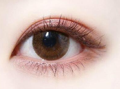 什么是眼睑下至术？真的能让眼睛变大吗？