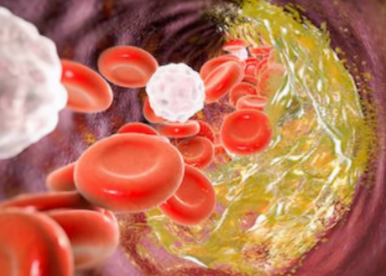 胆固醇高怎么办？胆固醇高的人吃什么食物好?