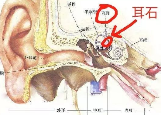 脑子天旋地转，可能是你耳朵里的“小石头”掉了