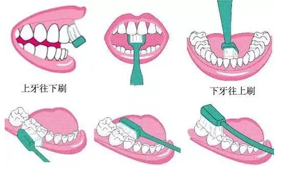 知道怎么正确刷牙吗？教大家刷牙的操作方法及流程步骤