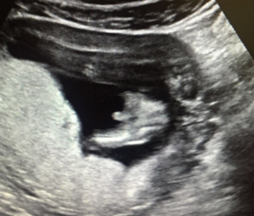 不同影像学检查有啥区别?用食物举例一篇告诉你! 不同影像学检查有啥区别?用食物举例一篇告诉你!