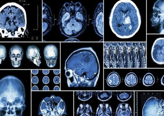 不同影像学检查有啥区别?用食物举例一篇告诉你！
