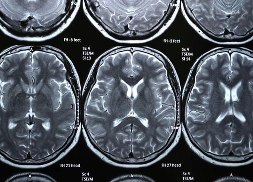 不同影像学检查有啥区别?用食物举例一篇告诉你! 不同影像学检查有啥区别?用食物举例一篇告诉你!