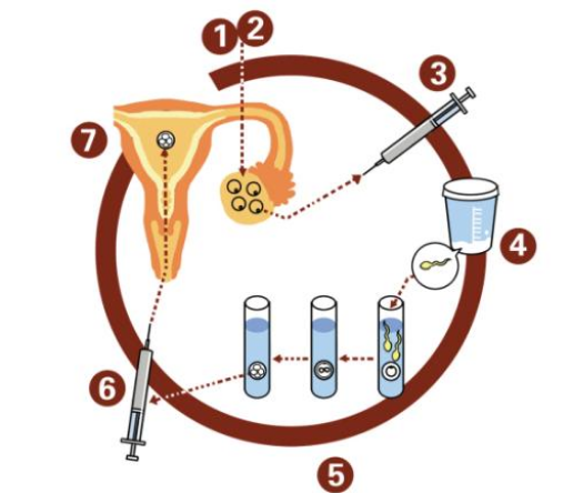湖北一女子试管婴儿双胞胎竟有两个爹?试管受精的验证过程到底有无问题! 湖北一女子试管婴儿双胞胎竟有两个爹?试管受精的验证过程到底有无问题!