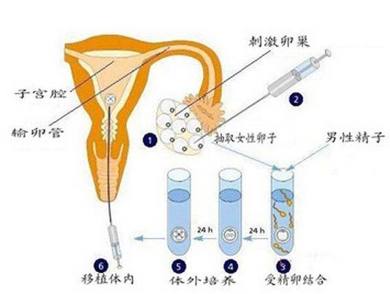 湖北一女子试管婴儿双胞胎竟有两个爹?试管受精的验证过程到底有无问题! 湖北一女子试管婴儿双胞胎竟有两个爹?试管受精的验证过程到底有无问题!