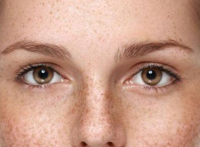 彩光嫩肤有什么好处?有这5种皮肤问题的一定要注意！
