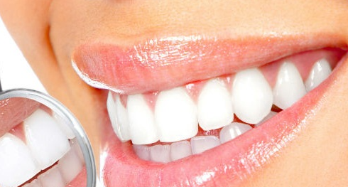 牙齿老是刷不白？美白试试这4种办法！
