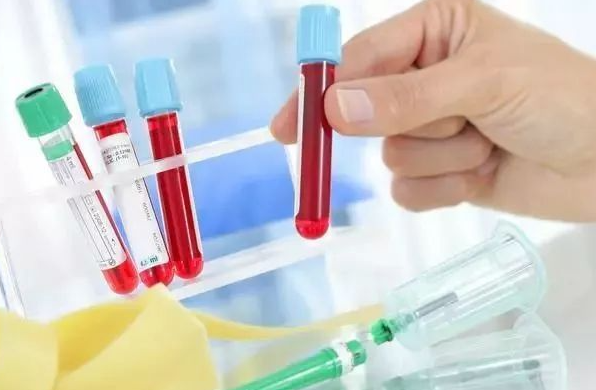 为什么一去医院看病,总是抽那么多管血? 为什么一去医院看病,总是抽那么多管血?